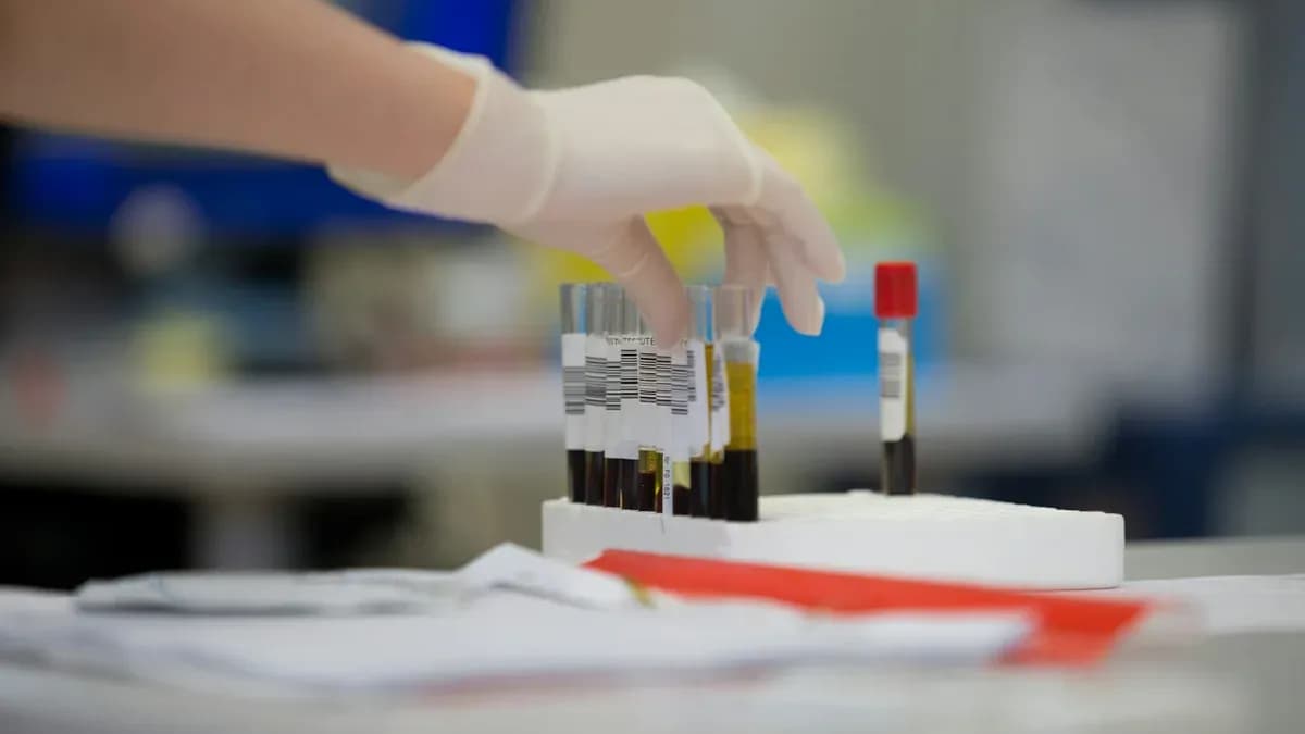 Cómo entender un resultado de laboratorio sin autodiagnosticarse